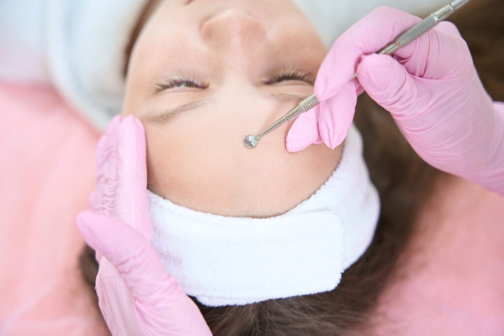 Dermaplanning